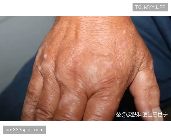 手部接触判定是什么规则?如何理解篮球中的合法与非法手部接触 手部接触判定是什么规则?如何理解篮球中的合法与非法手部接触